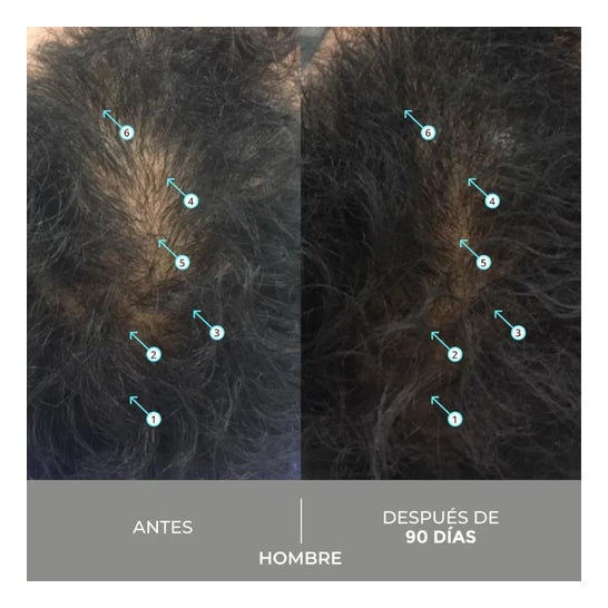 Spectral Dnc-S + Anti-Gray Serum 60ml Spectral Dnc-S + Anti-Gray Serum 60ml