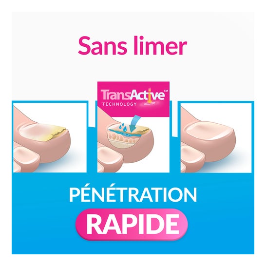 Excilor Mycose Des Ongles Solution 3,3ml