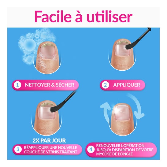 Excilor Mycose Des Ongles Solution 3,3ml