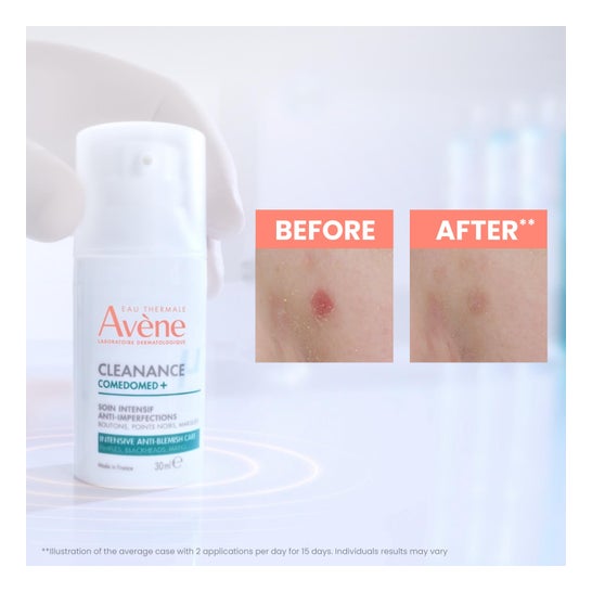 Avène Cleanance Comedomed+ Concentré Anti-Imperfections 30ml