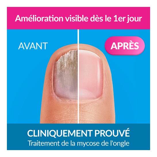 Excilor Forte Solution 30ml