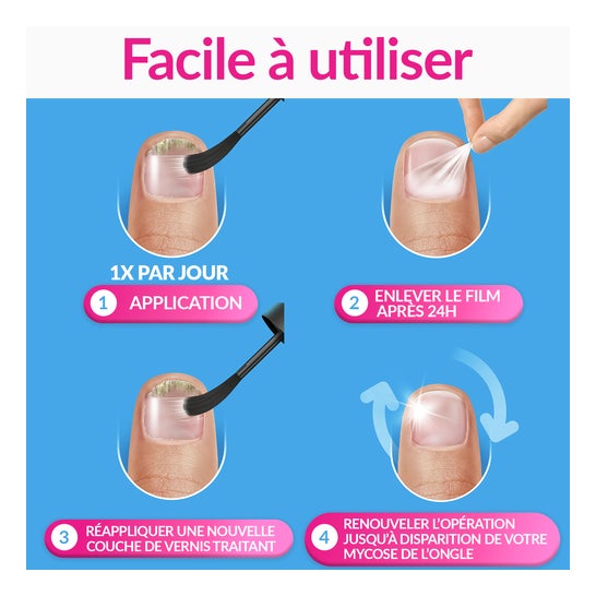 Excilor Forte Solution 30ml