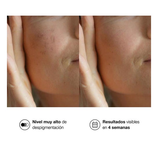 Bella Aurora Bio10 Forte 30ml