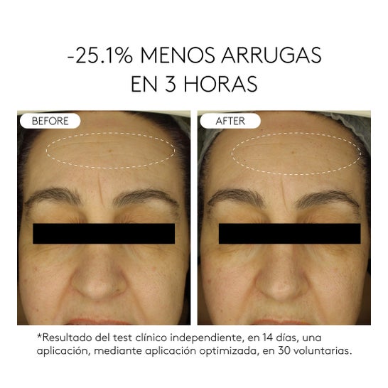 Cocunat Clinical Beauty Filler 5 ml