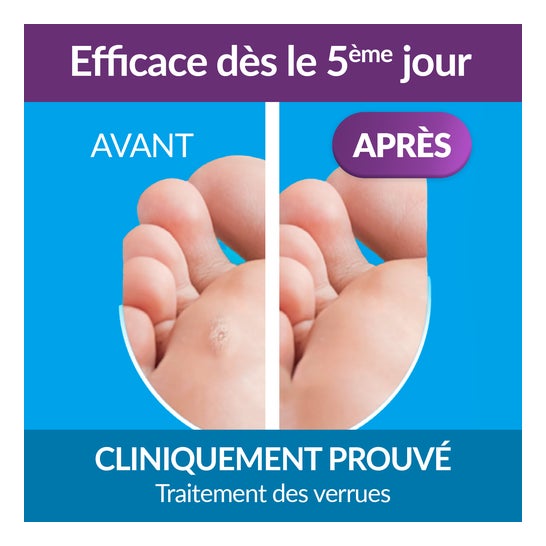 Excilor Traitement Des Verrues 2en1 Stylos