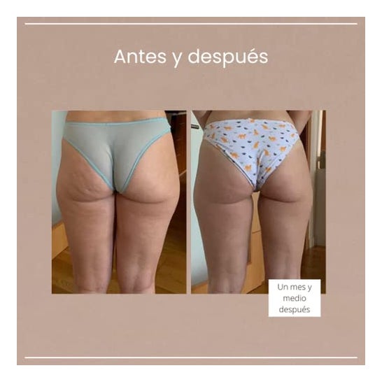 Mon Rebotica gel brûleur de graisse à effet froid 500ml Mon Rebotica gel brûleur de graisse à effet froid 500ml