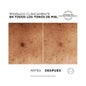 L'Oréal Bright Reveal Niacinamide Serum Dark Spots 30ml