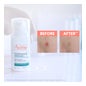 Avène Cleanance Comedomed+ Concentré Anti-Imperfections 30ml