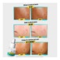 Kiehl's Truly Targeted Acne-Clearing Solution 15ml