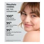 Acm Azéane Crème Acide Azélaique 15% 30ml