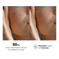 Bella Aurora Bio10 Forte Local Tratamiento Despigmentante 9ml