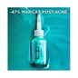 L'Oréal Bright Reveal Niacinamide Exfoliant Anti-taches 25ml